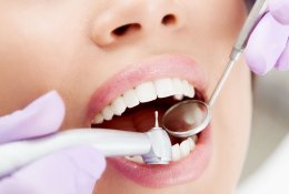Кариес зубов - методы лечения