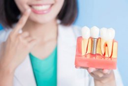 имплантация зубов вологда