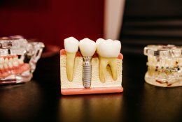 имплантация зубов поэтапно