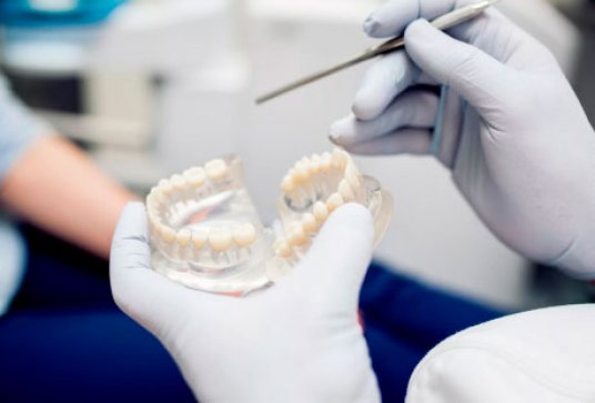 импланты зубов вологда